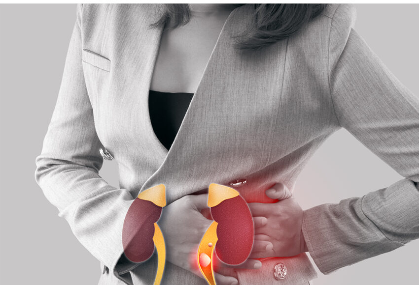 Kidney Cancer
