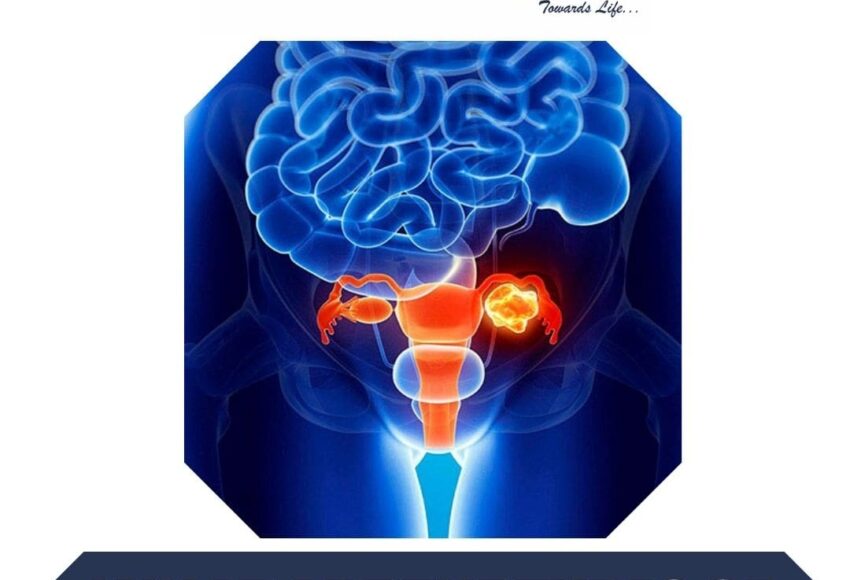 Urological cancer treatment in Pune