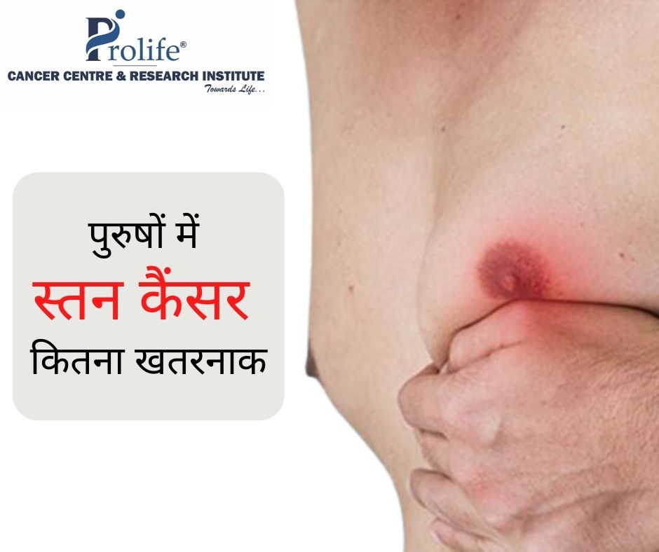Breast Cancer In Men | Prolife Cancer Centre