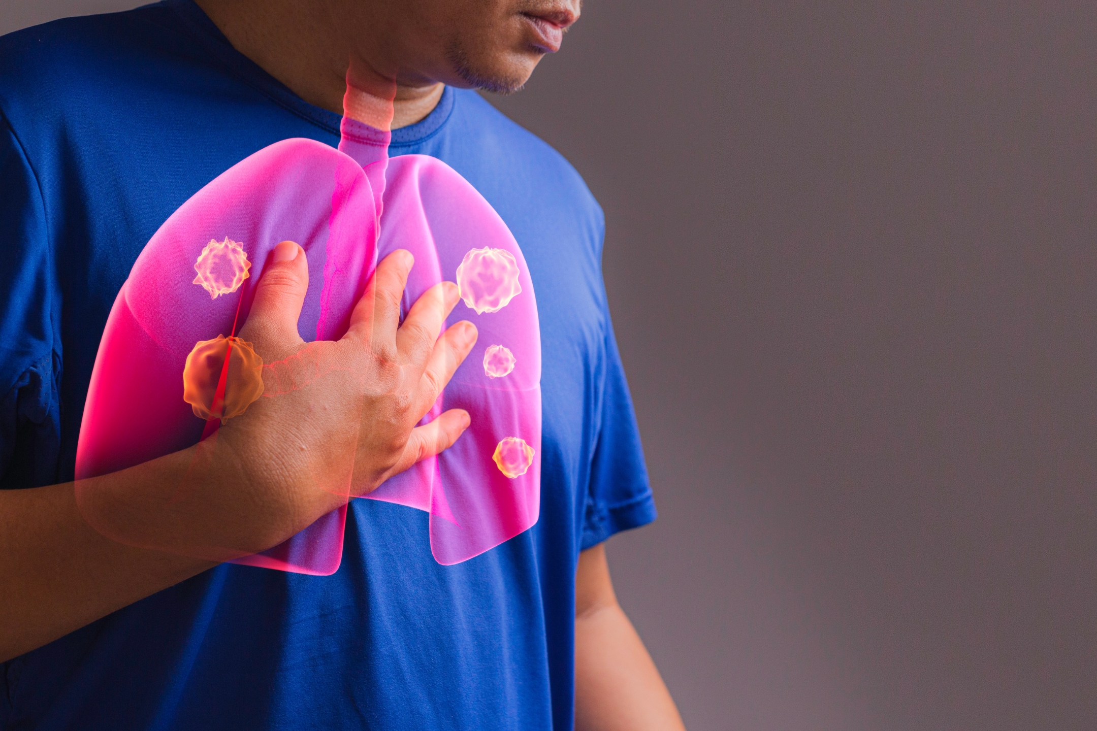 Thoracic Cancer